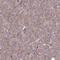Taxilin Alpha antibody, HPA045383, Atlas Antibodies, Immunohistochemistry paraffin image 