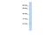 Serine/Threonine Kinase 32A antibody, A11981, Boster Biological Technology, Western Blot image 