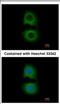 Tropomodulin 2 antibody, NBP2-20730, Novus Biologicals, Immunocytochemistry image 