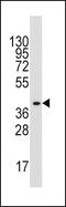 Aldolase, Fructose-Bisphosphate A antibody, PA5-12303, Invitrogen Antibodies, Western Blot image 