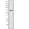 Guanylate Binding Protein 4 antibody, abx215570, Abbexa, Western Blot image 