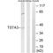 Tissue Specific Transplantation Antigen P35B antibody, A09921, Boster Biological Technology, Western Blot image 