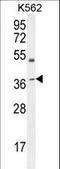 Apolipoprotein L6 antibody, LS-C156428, Lifespan Biosciences, Western Blot image 