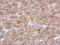 Asparagine Synthetase (Glutamine-Hydrolyzing) antibody, PA5-29973, Invitrogen Antibodies, Immunohistochemistry frozen image 