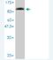 SLU7 Homolog, Splicing Factor antibody, H00010569-M01, Novus Biologicals, Western Blot image 