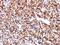 Carbonic Anhydrase 9 antibody, MBS439244, MyBioSource, Immunohistochemistry frozen image 