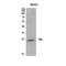 Prolactin antibody, STJ96889, St John