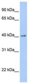 GDNF family receptor alpha-2 antibody, TA335008, Origene, Western Blot image 