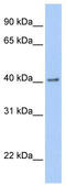 GDNF family receptor alpha-2 antibody, TA335008, Origene, Western Blot image 