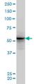 General Transcription Factor IIA Subunit 1 Like antibody, H00011036-M04, Novus Biologicals, Western Blot image 