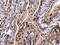 Chromodomain Helicase DNA Binding Protein 4 antibody, PA5-32181, Invitrogen Antibodies, Immunohistochemistry frozen image 