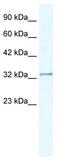 Nudix Hydrolase 9 antibody, TA338788, Origene, Western Blot image 