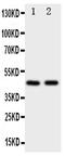 Flotillin 2 antibody, PA2034, Boster Biological Technology, Western Blot image 