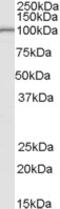 La Ribonucleoprotein Domain Family Member 1B antibody, MBS420547, MyBioSource, Western Blot image 