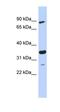 PDLIM1 Interacting Kinase 1 Like antibody, orb330704, Biorbyt, Western Blot image 