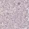 DEK Proto-Oncogene antibody, PA5-62975, Invitrogen Antibodies, Immunohistochemistry frozen image 