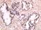 TYRO Protein Tyrosine Kinase Binding Protein antibody, orb156537, Biorbyt, Immunohistochemistry paraffin image 