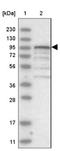 ATP Binding Cassette Subfamily G Member 8 antibody, NBP1-83388, Novus Biologicals, Western Blot image 