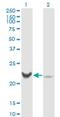 Recoverin antibody, H00005957-M02, Novus Biologicals, Western Blot image 