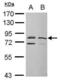 DEAD-Box Helicase 3 X-Linked antibody, PA5-29170, Invitrogen Antibodies, Western Blot image 