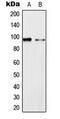 Mitogen-Activated Protein Kinase 6 antibody, MBS8233450, MyBioSource, Western Blot image 