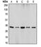 DNA Fragmentation Factor Subunit Alpha antibody, orb213845, Biorbyt, Western Blot image 