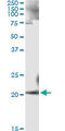 Ankyrin-1 antibody, LS-C196658, Lifespan Biosciences, Immunoprecipitation image 