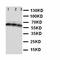 ADAM Metallopeptidase Domain 17 antibody, orb89692, Biorbyt, Western Blot image 