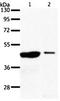 Arylacetamide Deacetylase Like 4 antibody, orb107612, Biorbyt, Western Blot image 