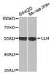 CD4 antibody, A1549, ABclonal Technology, Western Blot image 