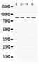 Phosphoinositide-3-Kinase Regulatory Subunit 2 antibody, PB9777, Boster Biological Technology, Western Blot image 