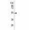 CCZ1 Homolog, Vacuolar Protein Trafficking And Biogenesis Associated antibody, F40074-0.4ML, NSJ Bioreagents, Western Blot image 