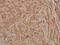 3-Phosphoinositide Dependent Protein Kinase 1 antibody, A01159S241, Boster Biological Technology, Immunohistochemistry paraffin image 