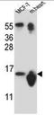 Small Nuclear Ribonucleoprotein D3 Polypeptide antibody, AP53967PU-N, Origene, Western Blot image 