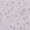 MAGE Family Member B3 antibody, NBP2-58828, Novus Biologicals, Immunohistochemistry frozen image 