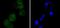 Cyclin Dependent Kinase 4 antibody, A00159, Boster Biological Technology, Immunocytochemistry image 