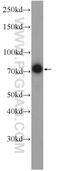 FRAS1 Related Extracellular Matrix 1 antibody, 13086-1-AP, Proteintech Group, Western Blot image 