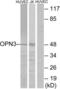 Opsin 3 antibody, LS-C120809, Lifespan Biosciences, Western Blot image 