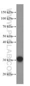 Glutathione S-Transferase Omega 1 antibody, 60150-2-Ig, Proteintech Group, Western Blot image 