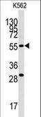 Chloride Intracellular Channel 5 antibody, LS-C100215, Lifespan Biosciences, Western Blot image 