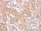 ADAM Metallopeptidase Domain 11 antibody, LS-C402859, Lifespan Biosciences, Immunohistochemistry paraffin image 