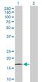 Protein Phosphatase 1 Regulatory Inhibitor Subunit 14A antibody, H00094274-D01P, Novus Biologicals, Western Blot image 