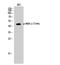 Mitogen-Activated Protein Kinase Kinase 3 antibody, STJ90329, St John