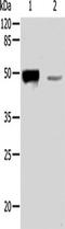 Hair keratin, type I Ha1 antibody, TA323042, Origene, Western Blot image 