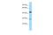 DnaJ Heat Shock Protein Family (Hsp40) Member C8 antibody, A14399, Boster Biological Technology, Western Blot image 