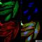 Keratin 1 antibody, NB100-2756, Novus Biologicals, Immunofluorescence image 