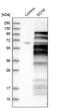 SRY-Box 6 antibody, NBP1-86149, Novus Biologicals, Western Blot image 