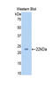 Slit Guidance Ligand 1 antibody, LS-C302010, Lifespan Biosciences, Western Blot image 