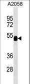 Alpha-L-Fucosidase 2 antibody, LS-C166276, Lifespan Biosciences, Western Blot image 