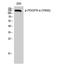 Platelet Derived Growth Factor Receptor Alpha antibody, STJ90601, St John